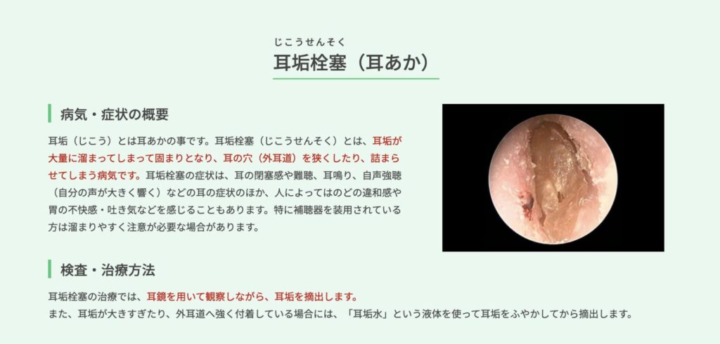 匠の耳かき 耳かき 必要